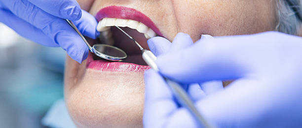 Best Emergency Dental Care for Broken or Chipped Teeth in Braidwood, IL